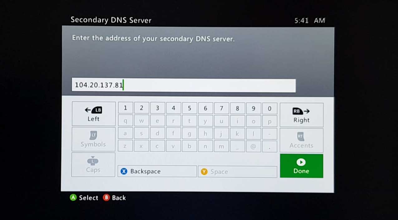 Dns xbox deals one s